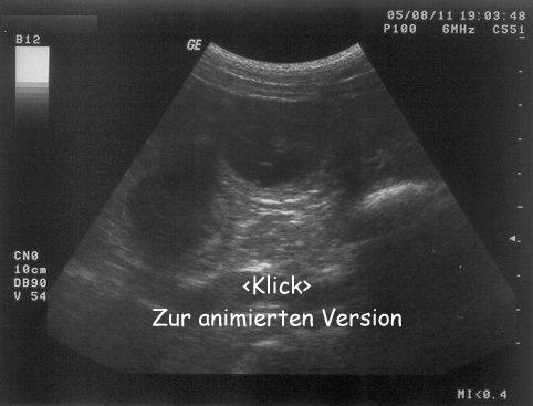 Anklicken (Ladezeiten beachten und abwarten)